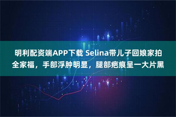 明利配资端APP下载 Selina带儿子回娘家拍全家福，手部浮肿明显，腿部疤痕呈一大片黑